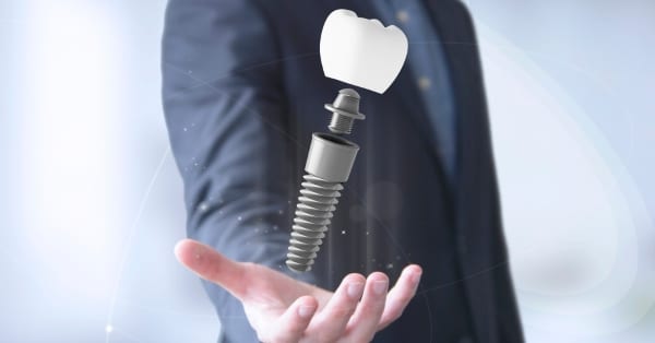 רשלנות רפואית בשתלים לשיניים